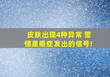 皮肤出现4种异常 警惕是癌症发出的信号!